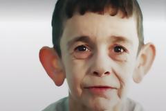 ΑΥΤΟΣ ο 7χρονος είναι ΚΑΤΑΔΙΚΑΣΜΕΝΟΣ να “ζει στο σώμα” 70χρονου – Συγκλονίζει η εικόνα του