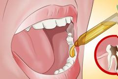 Έτσι θα απαλύνετε τον πονόδοντο με φυσικό τρόπο. Ακόμη και ο οδοντίατρός σας θα μείνει άφωνος με ΑΥΤΗ τη θαυματουργή συνταγή!