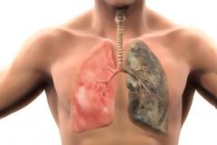 Σε πόσο καιρό θα καθαρίσουν οι πνεύμονες, αν κόψετε σήμερα το κάπνισμα