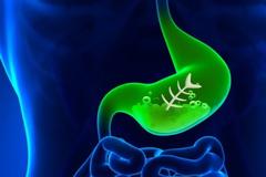 Πώς θα αντιμετωπίσετε την καούρα με φυσικό ρόφημα