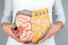 ΚΑΡΚΙΝΟΣ του παχέος εντέρου: Πώς μπορούμε να ΠΡΟΣΤΑΤΕΥΤΟΥΜΕ;