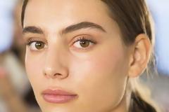 5 φυσικοί τρόποι για να απαλλαγείς από τους μαύρους κύκλους