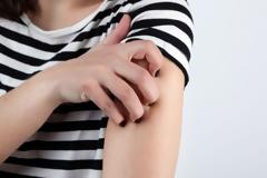 Έκζεμα: Πώς θα κλείσετε τον κύκλο της φαγούρας