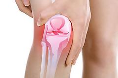 Ταλαιπωρημένα γόνατα: Γιατί φταίει ο σύγχρονος τρόπος ζωής