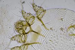 Κρούσματα ψώρας σε ξενοδοχείο με πρόσφυγες. “Μπαλάκι” οι ευθύνες