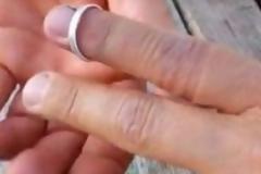 Μόνο έτσι θα καταφέρετε να βγάλετε τη σφηνωμένη βέρα από το δάκτυλο σας!