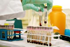 Χωρίς ελέγχους αντιντόπινγκ τα παιχνίδια της Super League