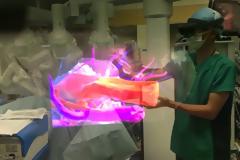 Τεχνολογία επαυξημένης πραγματικότητας στην Ιατρική