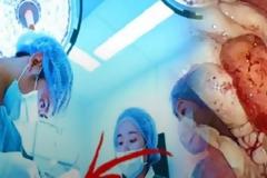 Ενώ της έκαναν εγχείρηση σκωληκοειδίτιδας είδαν κάτι παράξενο στην ωοθήκη της...Μόλις κατάλαβαν τι ήταν, πάγωσαν!