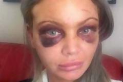 Μεθυσμένη μητέρα έβγαλε την οργή της σε άγνωστο άτομο