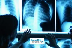 ΕΟΠΥΥ: Διαχωρίζονται τα κονδύλια για τις διαγνωστικές εξετάσεις! Όλες οι λεπτομέρειες