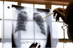 ΦΡΙΚΙΑΣΤΙΚΟ: Γονείς δηλητηρίασαν και ΜΑΧΑΙΡΩΣΑΝ τα παιδιά τους επειδή...