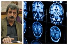 20 αξονικούς «μισθώνει» ο Πολάκης!