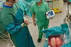 Γυναίκα έζησε 6 μέρες χωρίς πνεύμονες