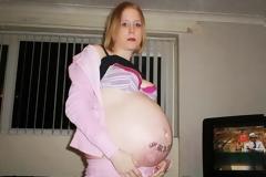 ΣΟΚ: Κι όμως αυτή η γυναίκα δεν είναι έγκυος – Δείτε τι έχει...