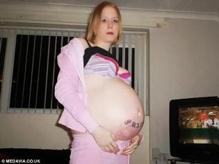 Φωτογραφία για ΣΟΚ: Κι όμως αυτή η γυναίκα δεν είναι έγκυος – Δείτε τι έχει...