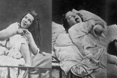 Οι πιο ΠΑΡΑΞΕΝΟΙ τρόποι αντιμετώπισης των πιο συχνών γυναικείων παθήσεων τον 19ο Αιώνα θα σας... σοκάρουν!