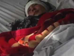 Φωτογραφία για Φρίκη! Aφγανός έκοψε και τα δύο αυτιά της 23χρονης συζύγου του