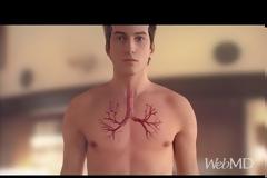 Παγκόσμια ημέρα άσθματος: Τι συμβαίνει κατά την διάρκεια μιας κρίσης άσθματος; (Βίντεο)