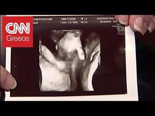 Φωτογραφία για Συγκλονιστικό! Έμβρυο αποχαιρετάει το δίδυμο αδελφάκι του (Video)