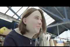 O άνθρωπος του μέλλοντος: Με καμπούρα και διπλό βλέφαρο