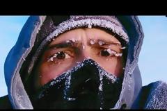 Υποθερμία: Συμπτώματα, αιτίες και αντιμετώπιση