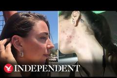 Πώς το κρέας έσωσε τη ζωή μιας vegan (βίντεο)